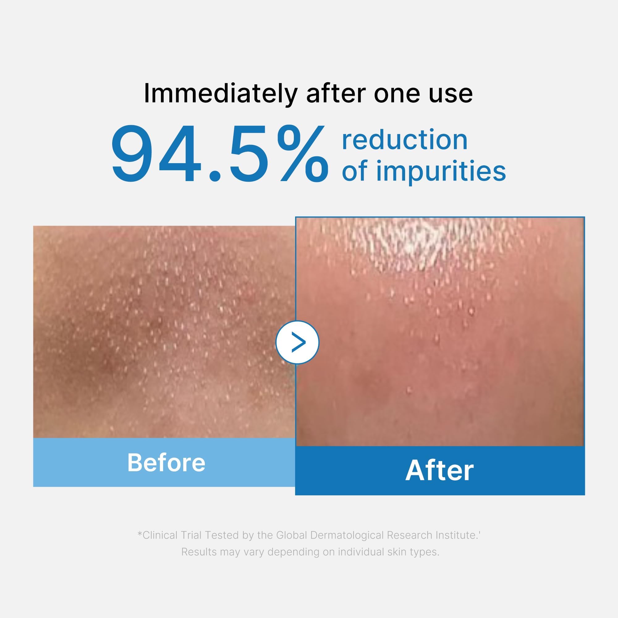 Medicube Zero Pore Blackhead Cleansing Oil 205ml - slika 2