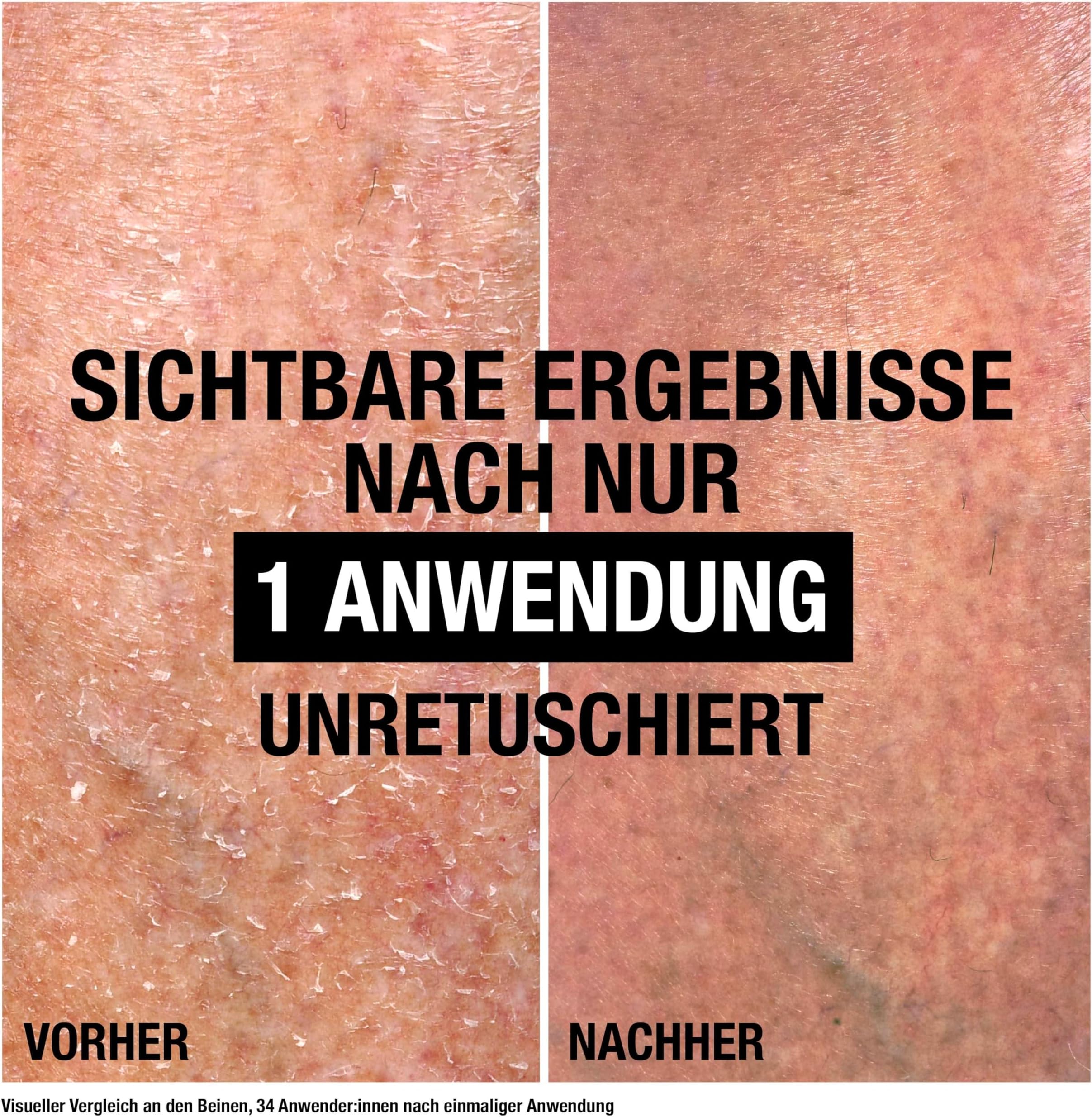 Neutrogena Norwegian Formula Intense Repair CICA 250ml - slika 3